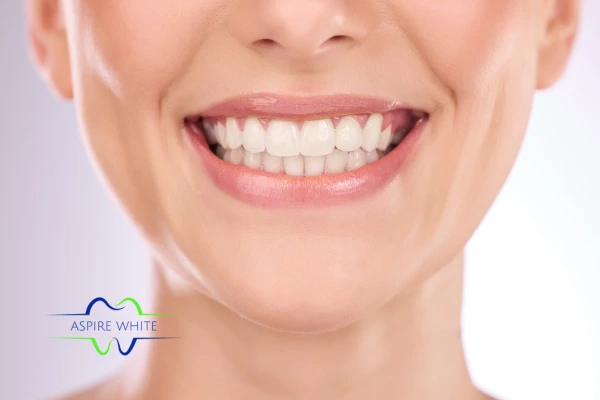 Follow your teeth whitening aftercare Archway to prolong your whiter smile!