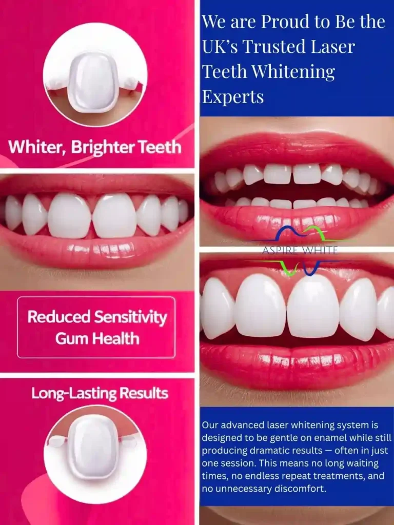 We are Proud to Be the UK’s Trusted Laser Teeth Whitening Experts Archway